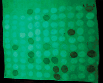 Image: Fluorescent spot test method for glucose-6-phosphate dehydrogenase deficiency (Photo courtesy of Dr. Tundun Williams). 